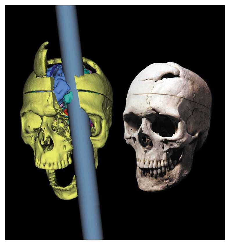 Phineas Gage, daguerreotype